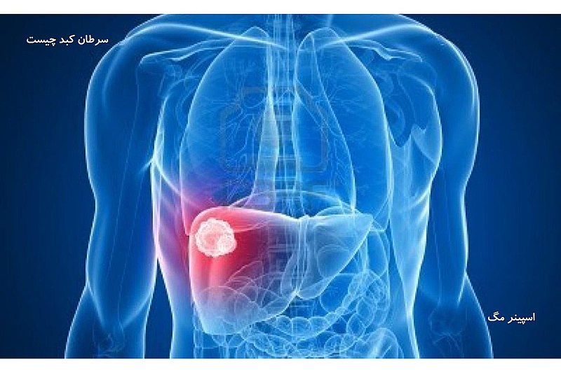 Tumors partially destroyed with sound waves don’t come back